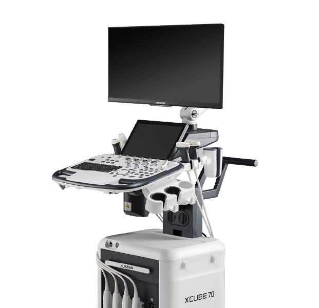 초음파 영상진단기